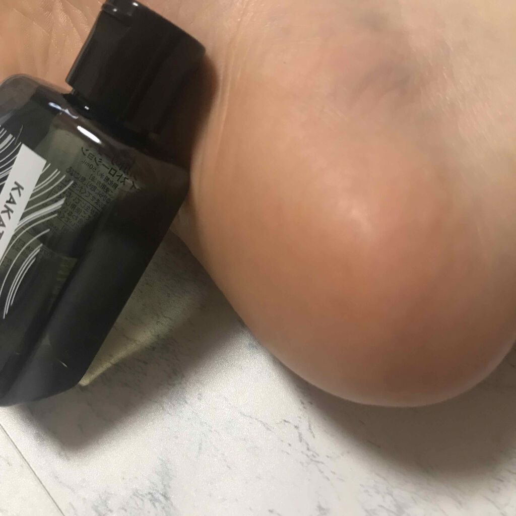 カカトリーヌモイストローション/KAKATOrine/レッグ・フットケアを使ったクチコミ（3枚目）