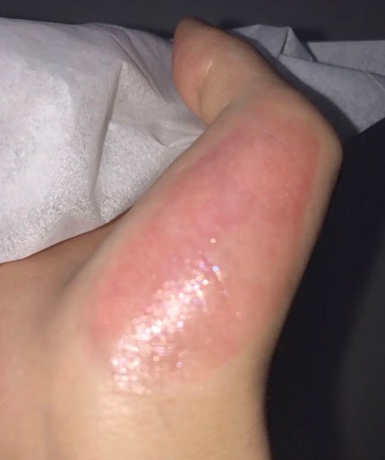 ディオール アディクト リップ マキシマイザー/Dior/リップグロスを使ったクチコミ(2枚目)