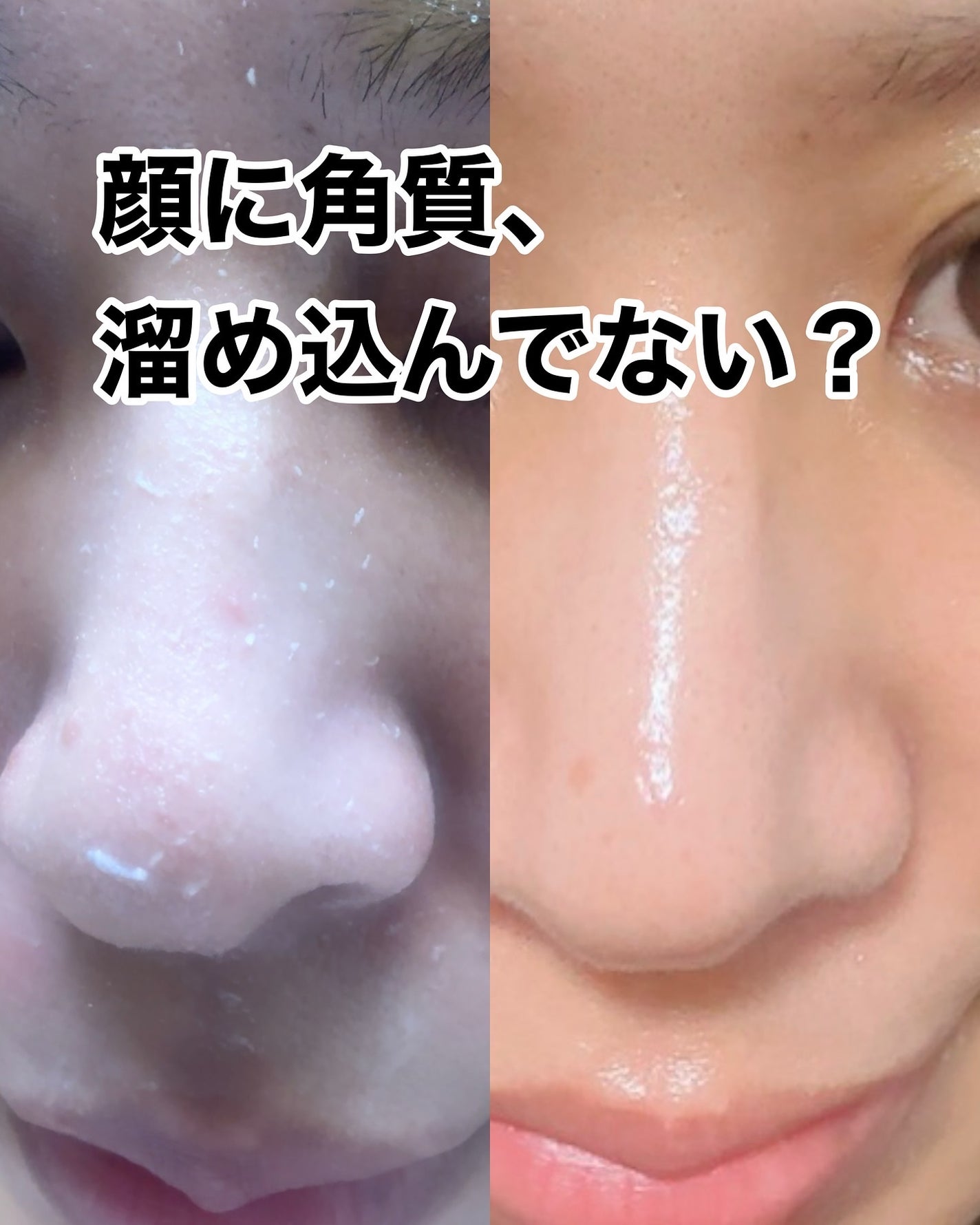 まるみ♡ on LIPS 「古い角質、顔に載せておいていいことないよ?みんなのお悩みに多い..」(1枚目)