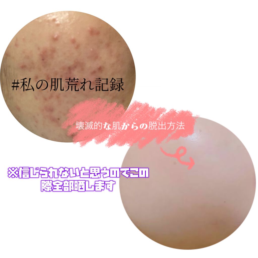 DHC ビタミンBミックス/DHC/美容サプリメントを使ったクチコミ(1枚目)