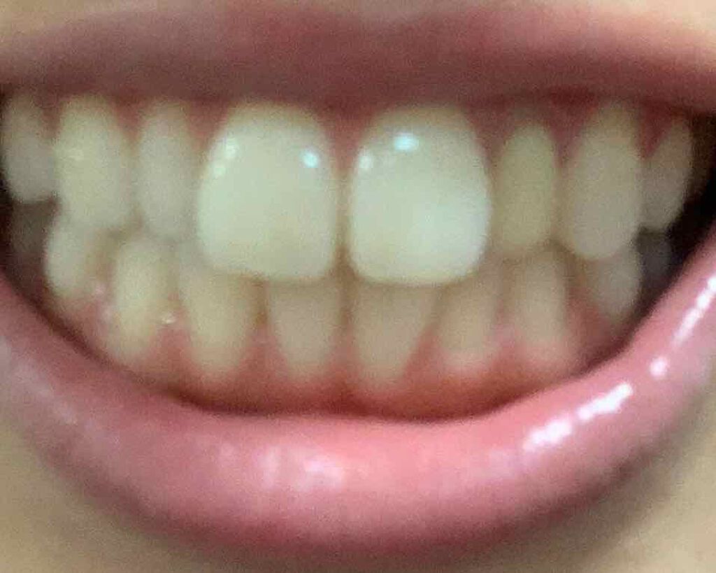 プレミアム クレンジングペースト/オーラツー/歯磨き粉を使ったクチコミ（2枚目）