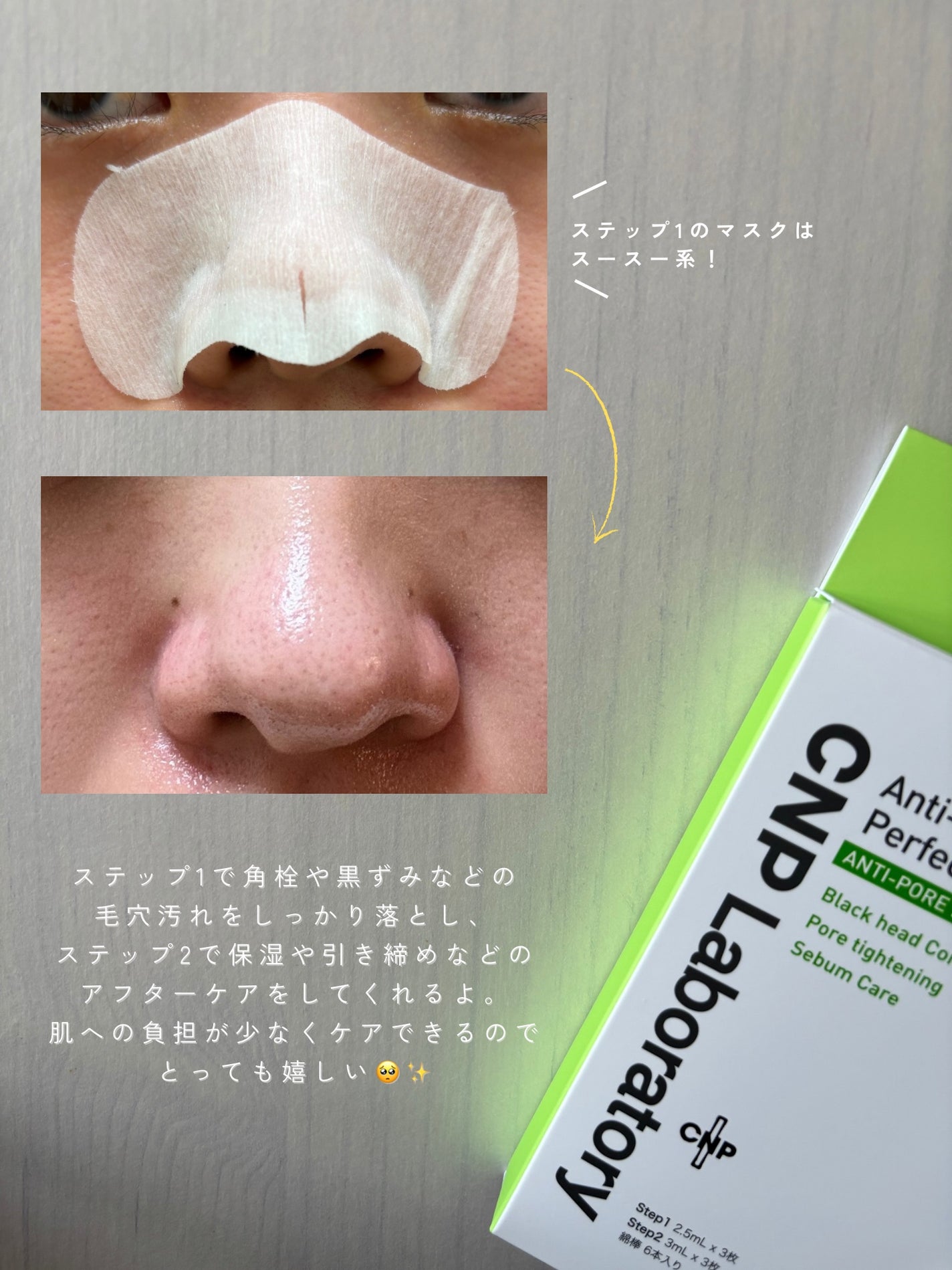 アンチポアブラックヘッドパーフェクトクリアキット/CNP Laboratory/シートマスク・パックを使ったクチコミ(3枚目)