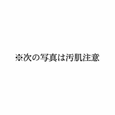 ナチュリエ ハトムギ保湿ジェル(ナチュリエ スキンコンディショニングジェル)のクチコミ「初めまして！ら る です！

4枚目の写真はお風呂上がりで申し訳ないです💦
もしかしてホクロも.....」（2枚目）