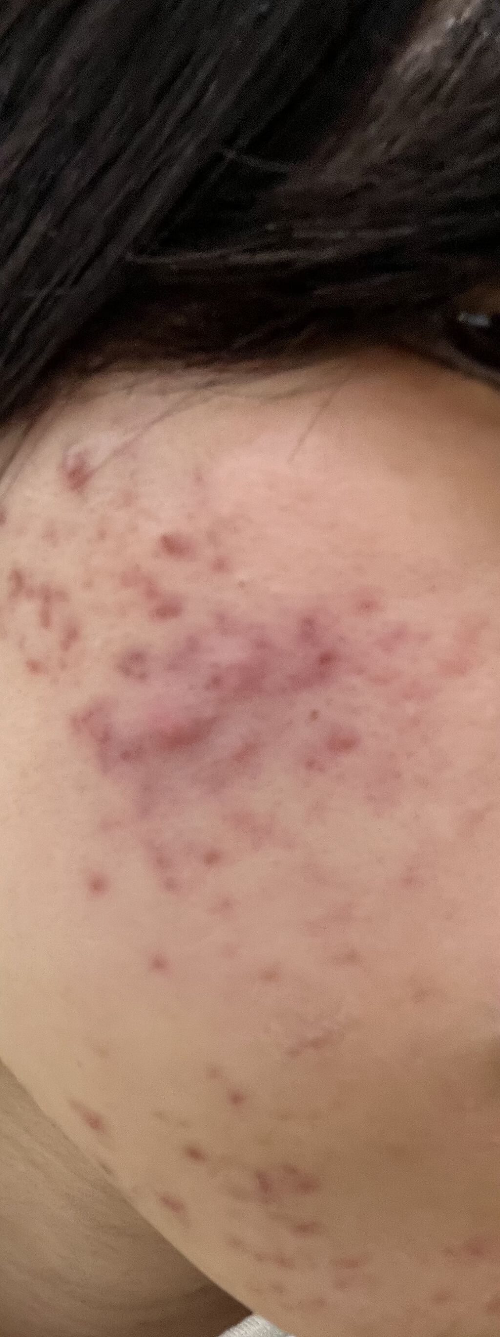 敏感肌用薬用美白美容液/無印良品/美容液を使ったクチコミ（2枚目）