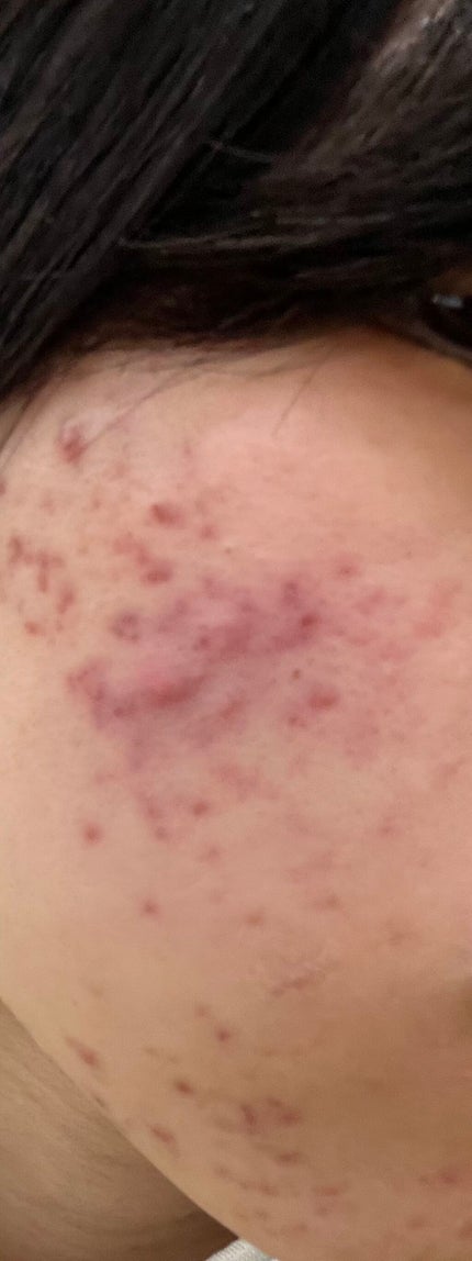 ハトムギ保湿ジェル(ナチュリエ スキンコンディショニングジェル)/ナチュリエ/美容液を使ったクチコミ(2枚目)