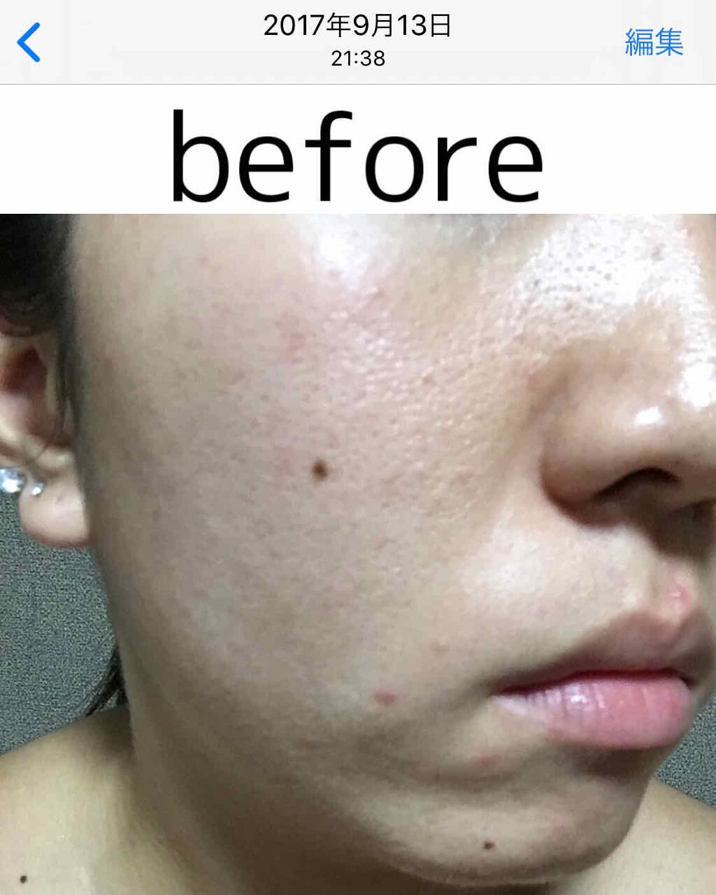 敏感肌用薬用美白美容液/無印良品/美容液を使ったクチコミ（2枚目）