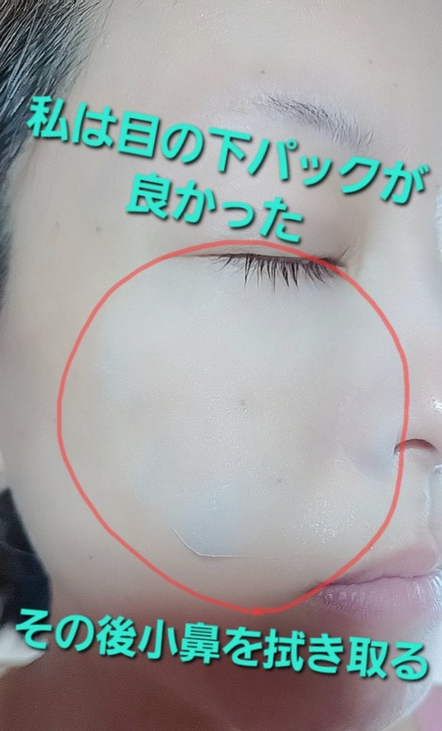 グリーンダーマCICAエッセンシャルパッド/ネイチャーリパブリック/トナーパッドを使ったクチコミ(3枚目)