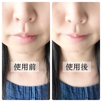 リップパック /CHOOSY/リップマスクを使ったクチコミ(4枚目)