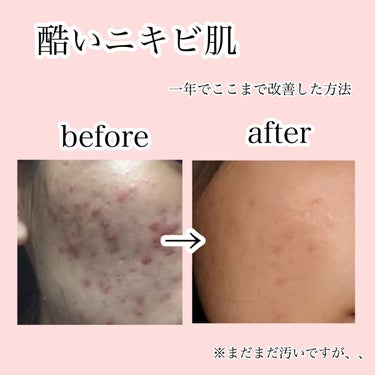 白潤プレミアム 薬用浸透美白化粧水(しっとりタイプ)/肌ラボ/化粧水を使ったクチコミ（1枚目）