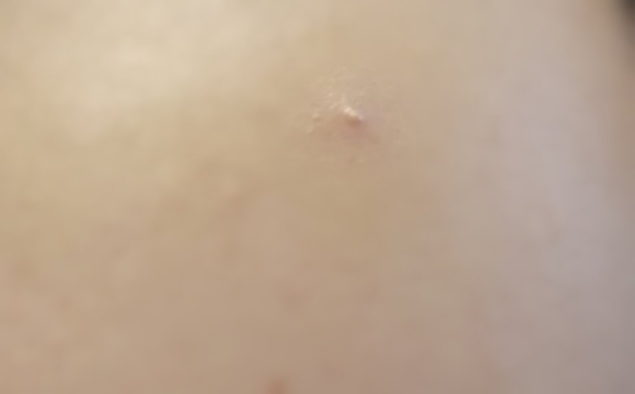 カバーパーフェクション チップコンシーラー 1.25 ライトベージュ/the SAEM/リキッドコンシーラーを使ったクチコミ（3枚目）