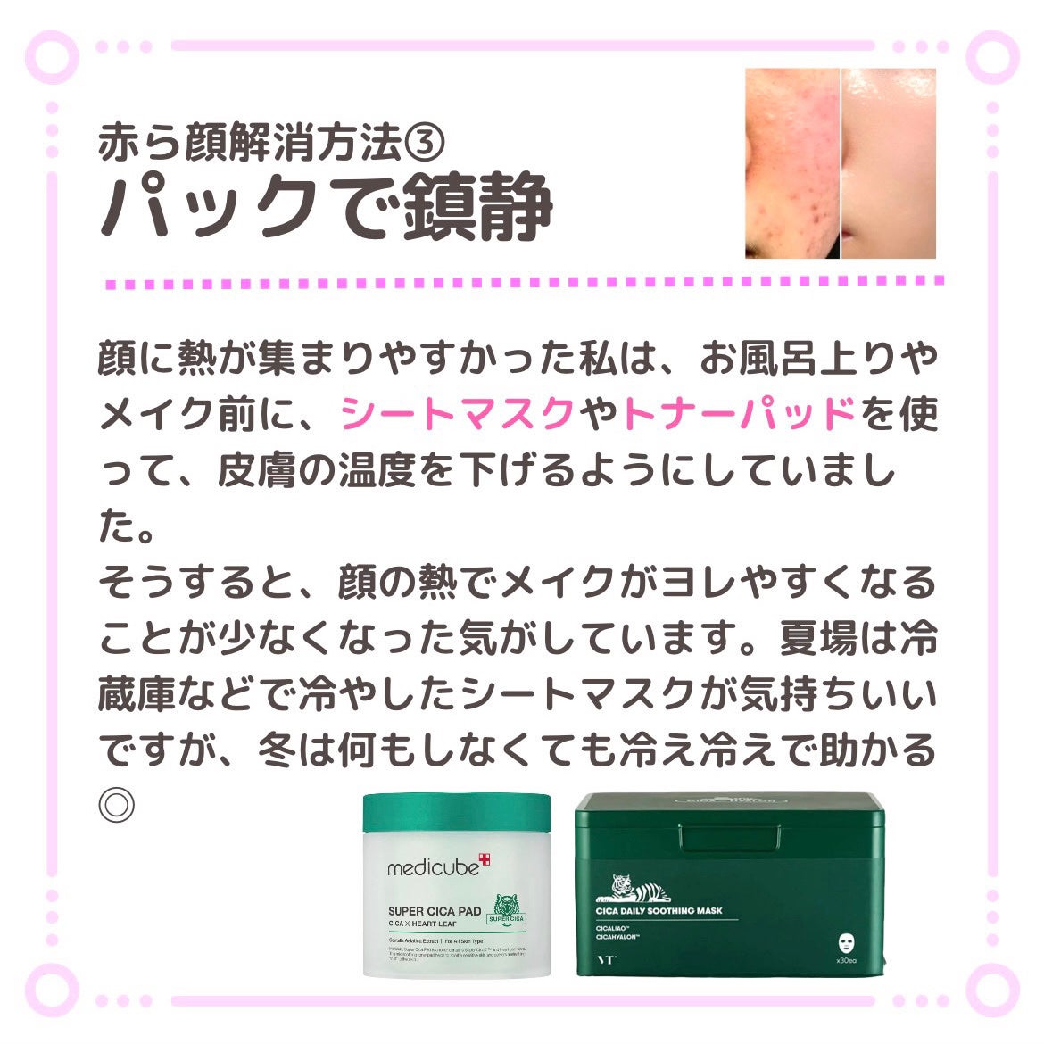CICA デイリースージングマスク/VT/シートマスク・パックを使ったクチコミ(4枚目)