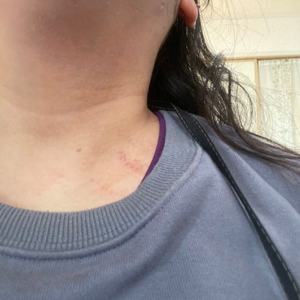 レチノールA 1% アドバンスドリバイタリゼーションクリーム/Life-flo/フェイスクリームを使ったクチコミ(2枚目)