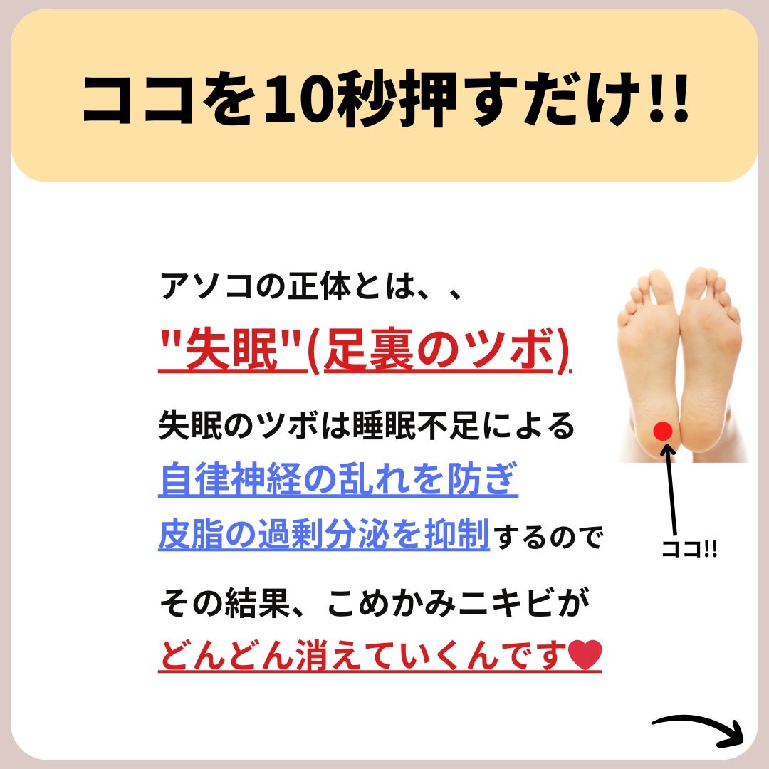 あなたの肌に合ったスキンケア💐コーくん先生 on LIPS 「【知らないと損】こめかみニキビできる原因がヤバすぎた.あなたの..」(5枚目)
