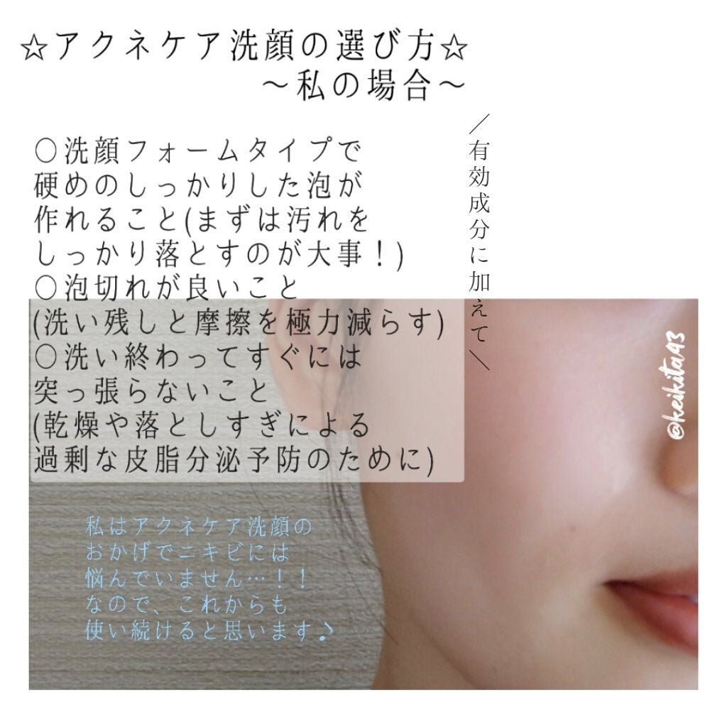 パーフェクトホイップ アクネケア/SENKA(専科)/洗顔フォームを使ったクチコミ(3枚目)