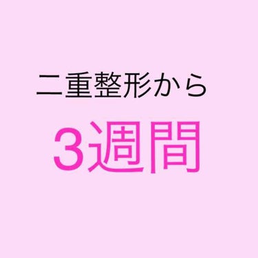 ⚠️目の写真あります！！！！


＿＿＿＿＿＿＿＿＿＿＿＿＿＿＿＿＿＿＿＿＿
二重整形してから、3週間が経ちました🌸🌸


この二重幅で大体定着していきます！
希望した幅とほとんど一緒で
きちんとした、