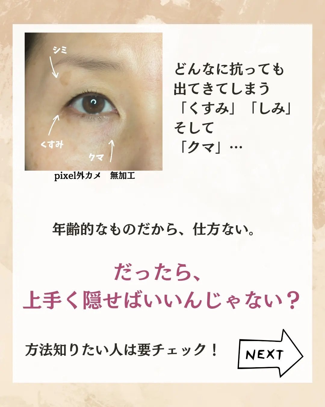 ディオールスキン フォーエヴァー スキン コレクト コンシーラー/Dior/リキッドコンシーラーを使ったクチコミ(2枚目)