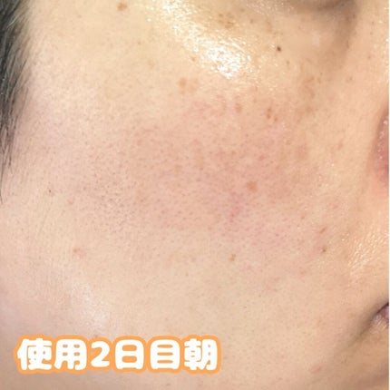 アレルバリア エッセンス BB/d プログラム/BBクリームを使ったクチコミ(2枚目)