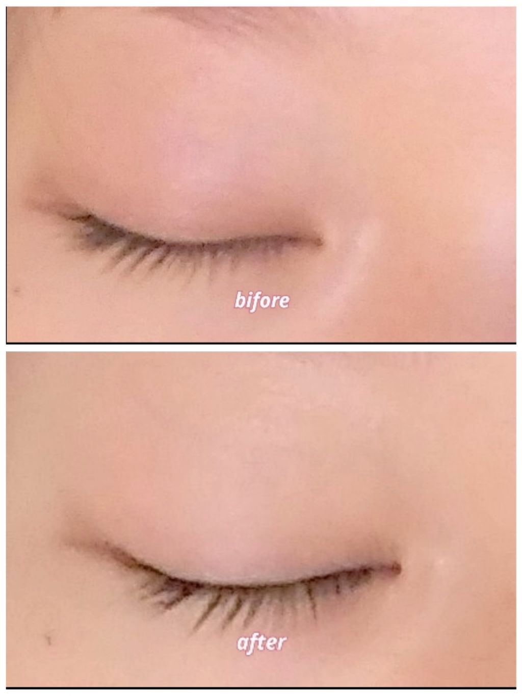 ローヤルゼリー配合 栄養ローション/DAISO/美容液を使ったクチコミ(1枚目)