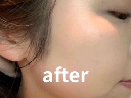 インフィニティカバークッション/Elishacoy/クッションファンデーションを使ったクチコミ(4枚目)