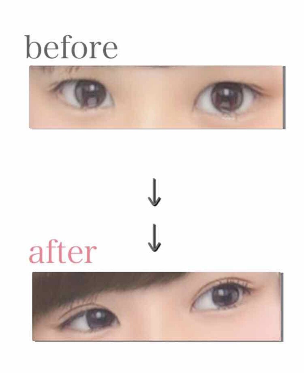 のびーるアイテープ（絆創膏タイプ、レギュラー）/DAISO/二重まぶた用アイテムを使ったクチコミ（1枚目）