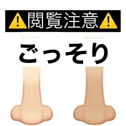 毛穴すっきりパック 鼻用 白色タイプ/ビオレ/その他スキンケアを使ったクチコミ(1枚目)
