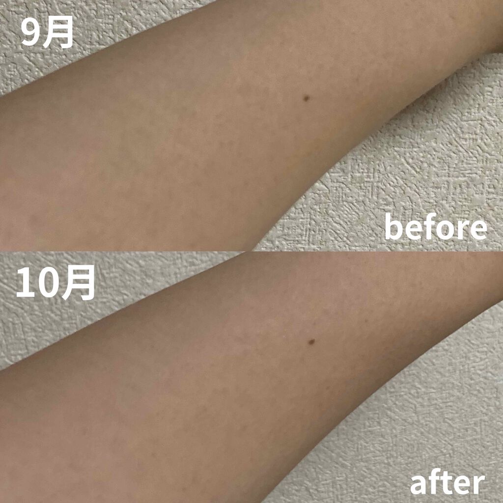 ハトムギ化粧水(ナチュリエ スキンコンディショナー R )/ナチュリエ/化粧水を使ったクチコミ（3枚目）