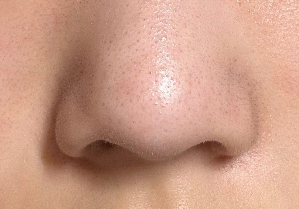 よんちょる on LIPS 「割とガチめに助けてください。最近スキンケアとかサボってたりして..」(3枚目)