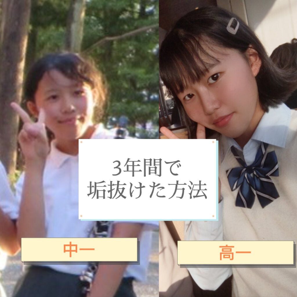 ハトムギ保湿ジェル(ナチュリエ スキンコンディショニングジェル)/ナチュリエ/美容液を使ったクチコミ(1枚目)