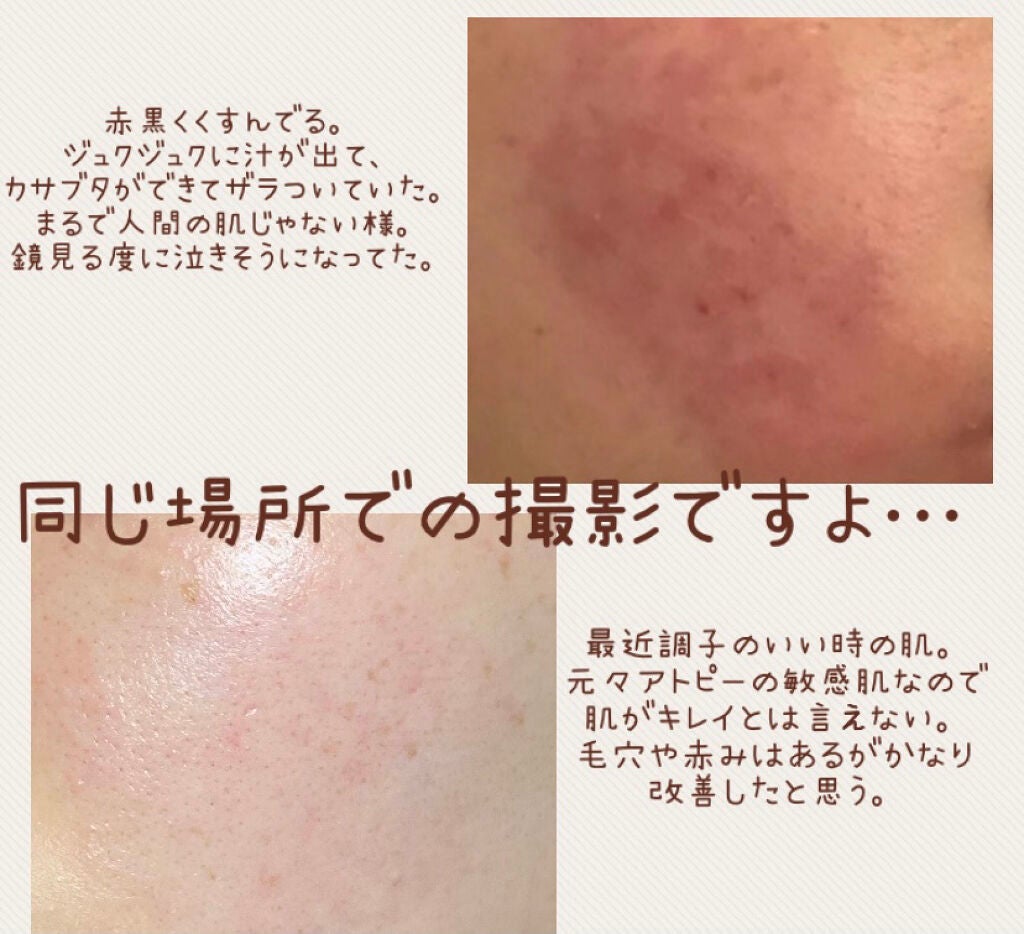 肌をうるおす保湿クリーム/肌をうるおす保湿スキンケア/フェイスクリームを使ったクチコミ(2枚目)