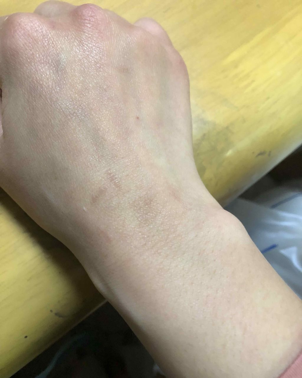 ユースキンA ファミリーメディカルクリーム/ユースキン/ハンドクリームを使ったクチコミ（3枚目）