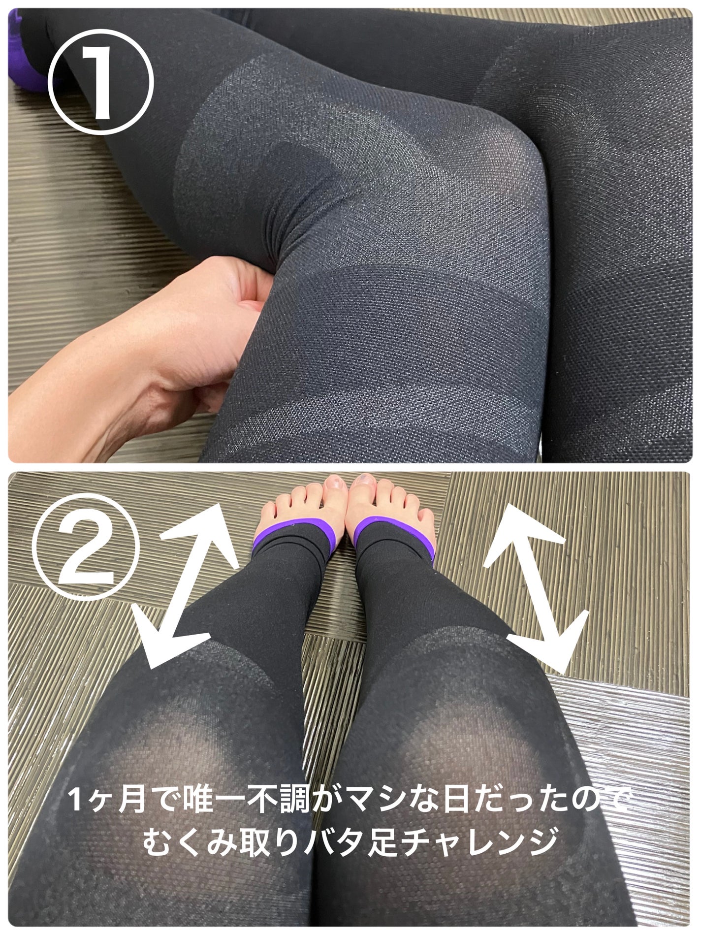 寝ながらメディキュット フルレッグ EX/メディキュット/着圧ソックス・レギンスを使ったクチコミ(1枚目)