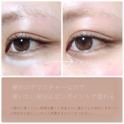 リンクルショット メディカル セラム N/リンクルショット/アイケア・アイクリームを使ったクチコミ(3枚目)