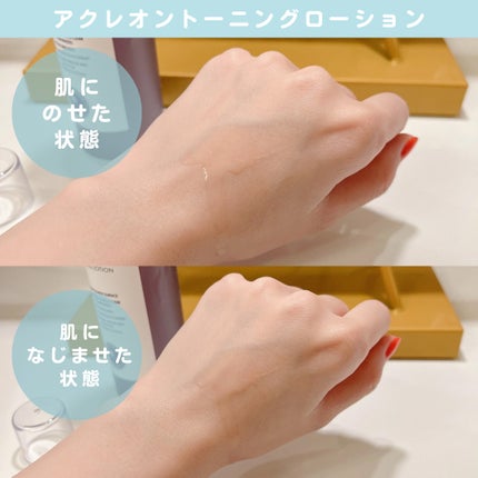 アクレオン トーニングローション/ANACIS/化粧水を使ったクチコミ(3枚目)