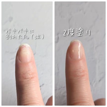 ストロングガード/D-UP/ネイル・ネイルケアを使ったクチコミ(4枚目)