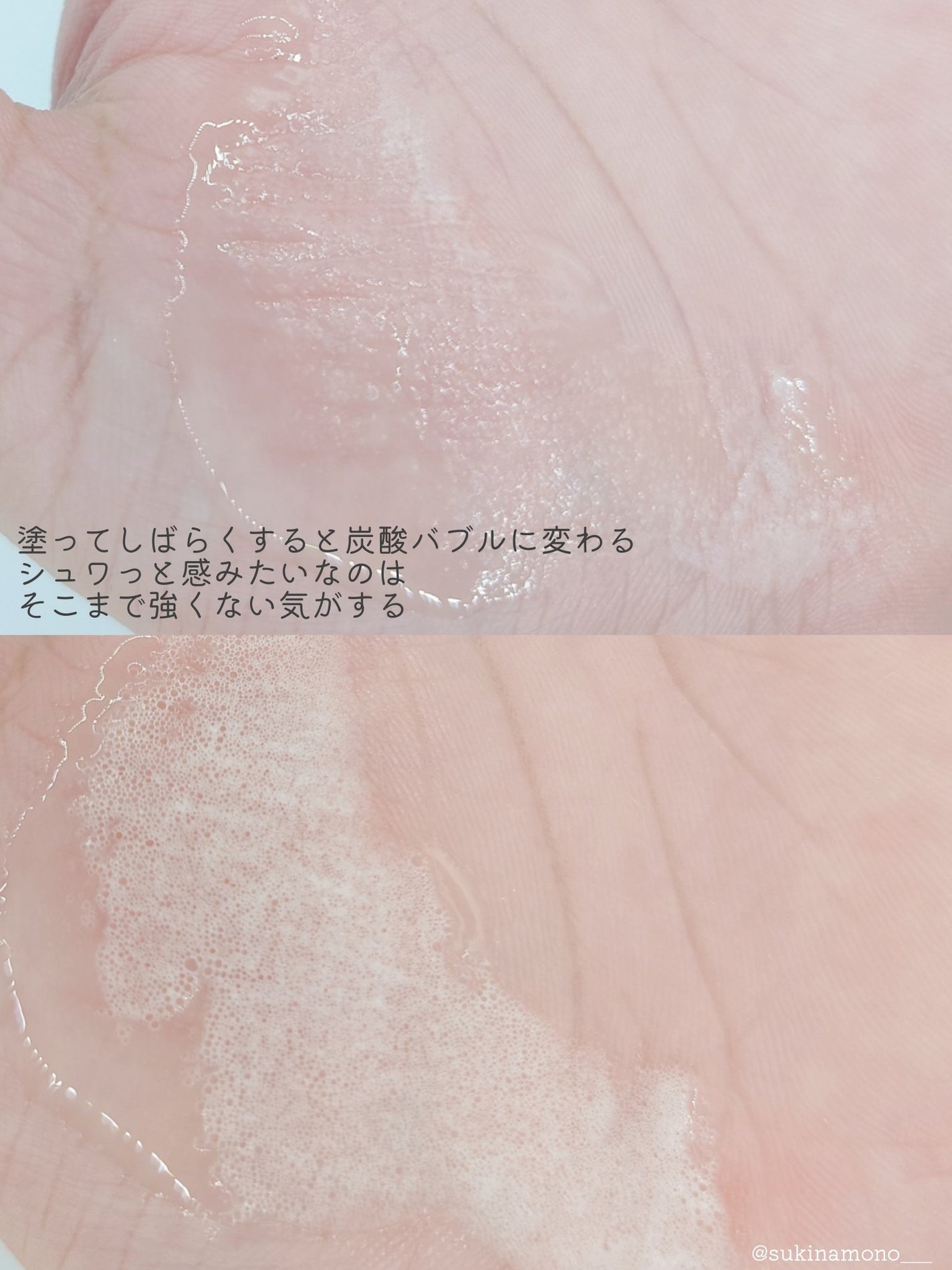 スパークリングスカルプスケーラー/ミンツリー/頭皮ケアを使ったクチコミ(5枚目)