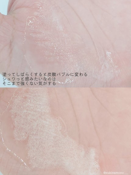 スパークリングスカルプスケーラー/ミンツリー/頭皮ケアを使ったクチコミ(5枚目)