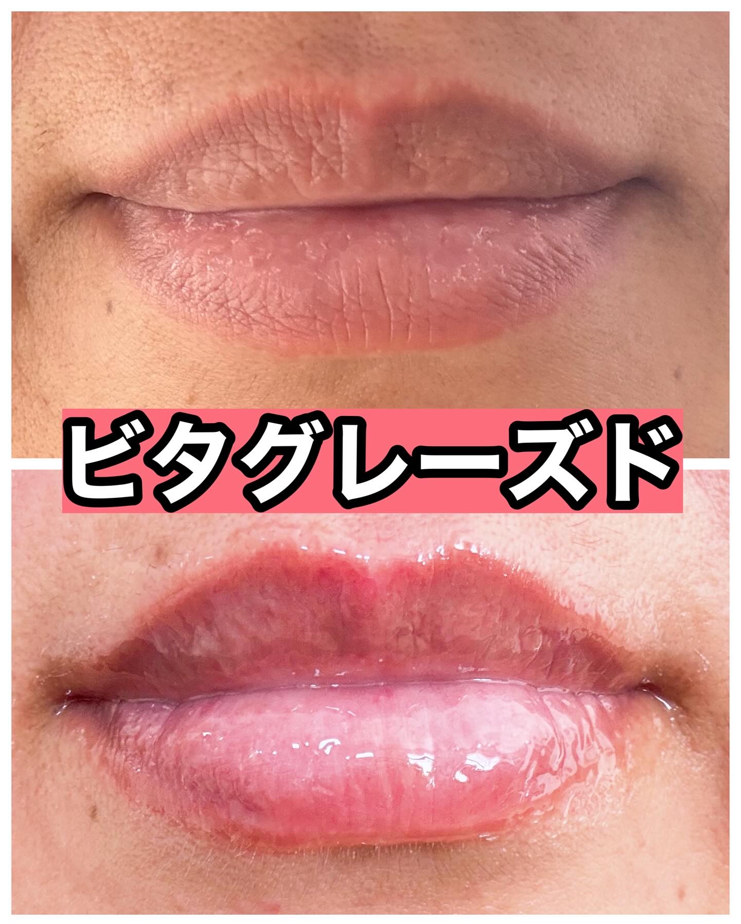 ビタグレーズドリップマスク/TOCOBO/リップマスクを使ったクチコミ（3枚目）