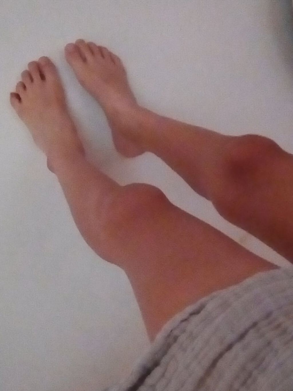 橋元奈々 on LIPS 「今日は、写真を見たとおり足が太いので細くできるか検証してみます..」(3枚目)