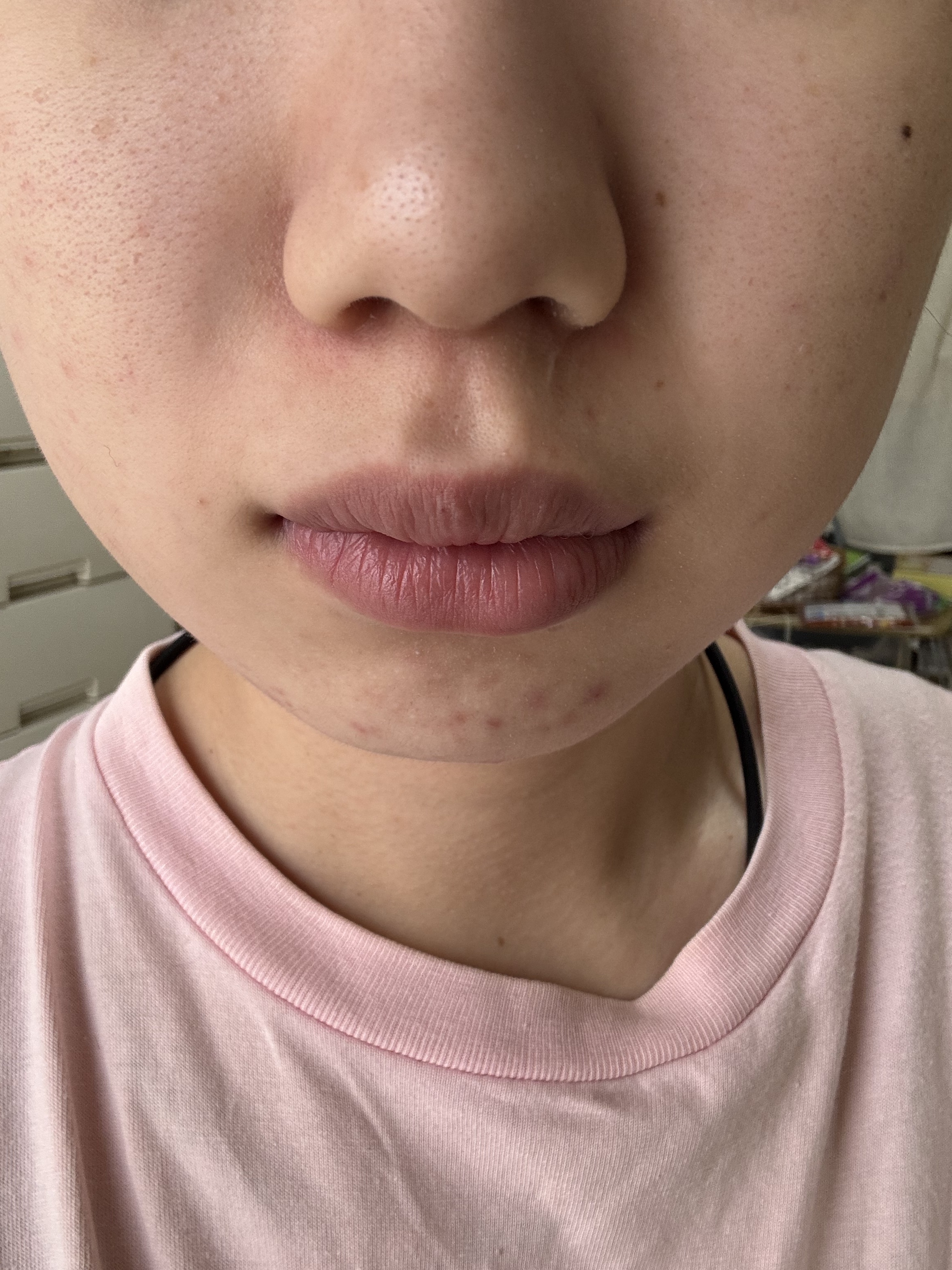 薬用しみ集中対策 プレミアム美容液/メラノCC/美容液を使ったクチコミ（3枚目）