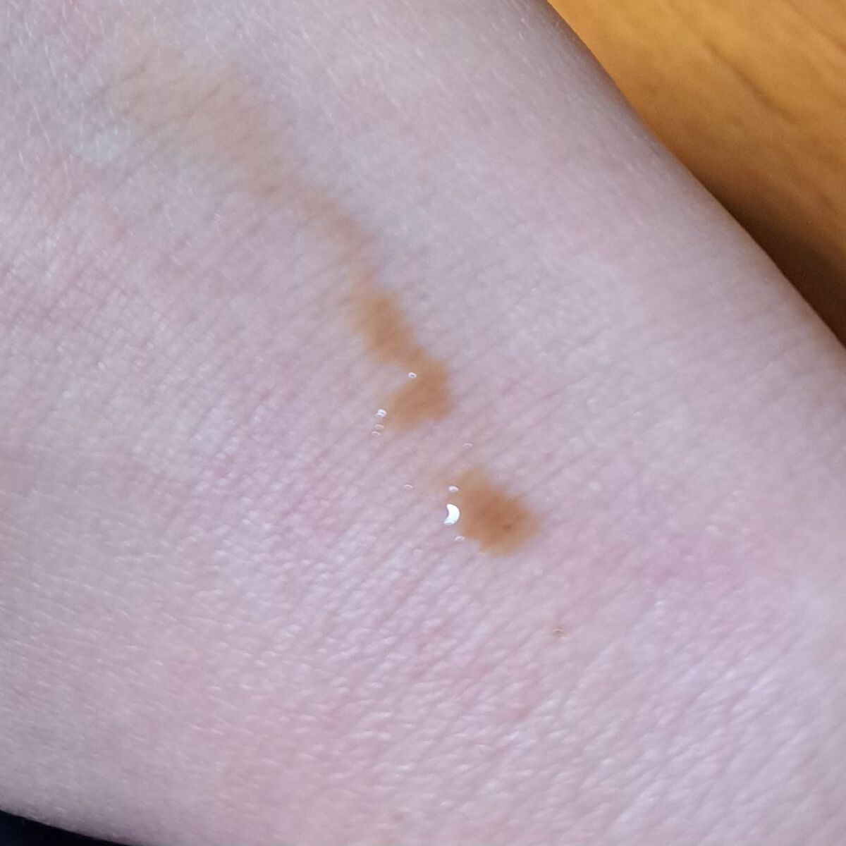 業務用ハイドロキノン/旭研究所/その他スキンケアを使ったクチコミ（3枚目）