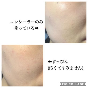 【旧】ディオールスキン フォーエヴァー スキン コレクト コンシーラー/Dior/リキッドコンシーラーを使ったクチコミ（4枚目）