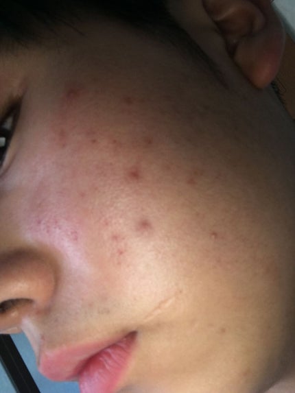 化粧水・敏感肌用・高保湿タイプ/無印良品/化粧水を使ったクチコミ(2枚目)