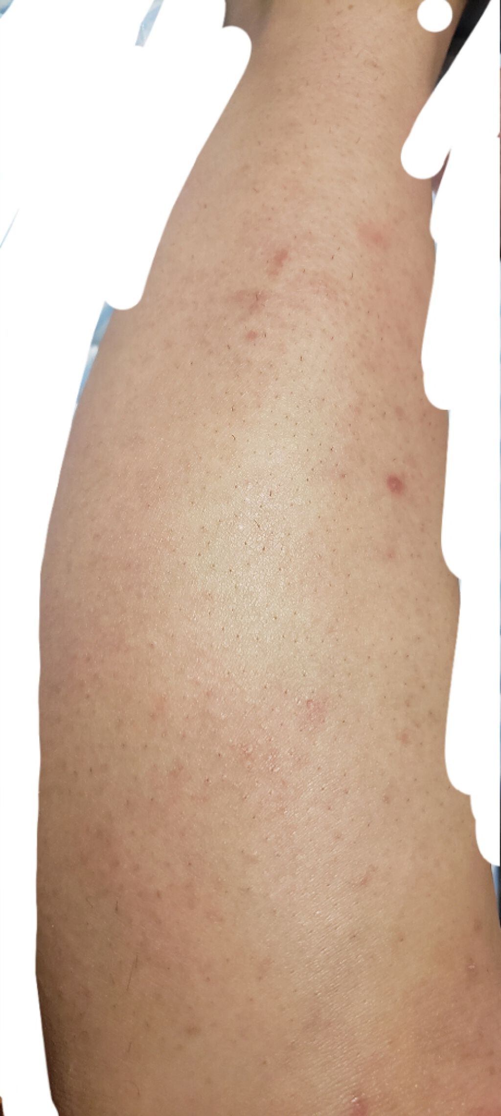 除毛クリームキット敏感肌用/エピラット/除毛クリームを使ったクチコミ(3枚目)