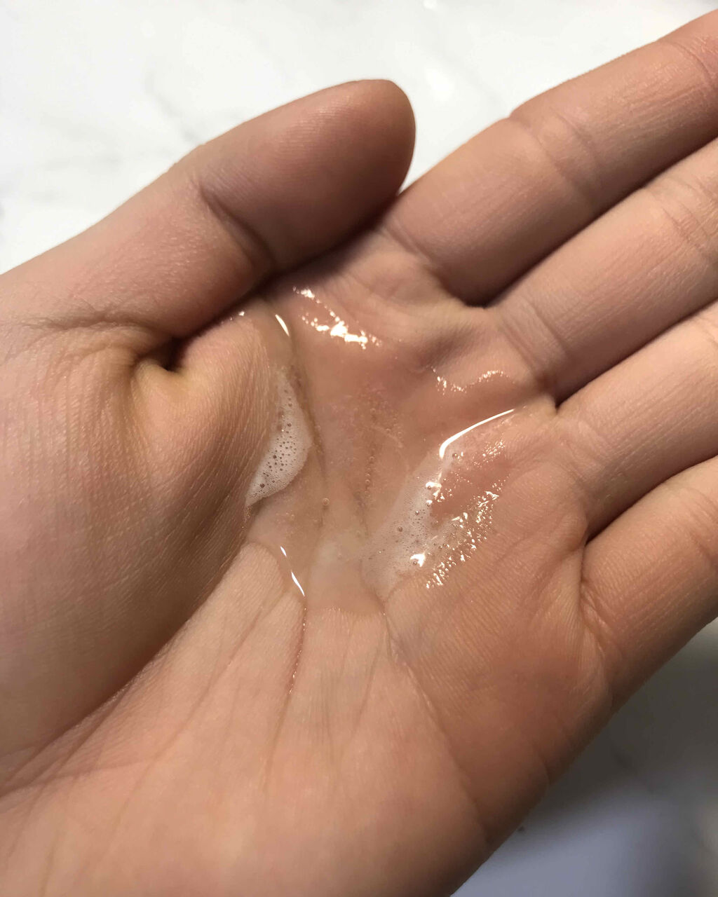 アクネケア エマルジョン R/d プログラム/乳液を使ったクチコミ（3枚目）