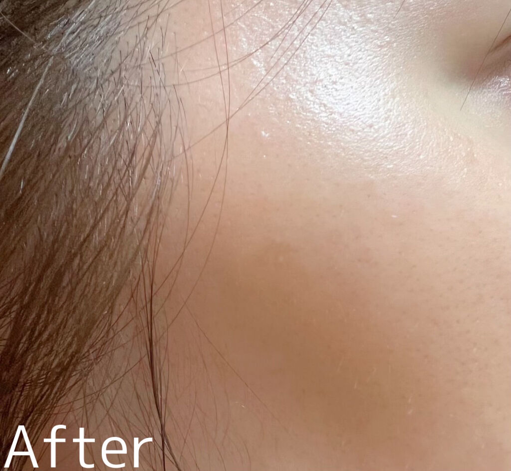 SUMAKIE Serum ヒト臍帯血美容液/スマキエセラム/美容液を使ったクチコミ（3枚目）