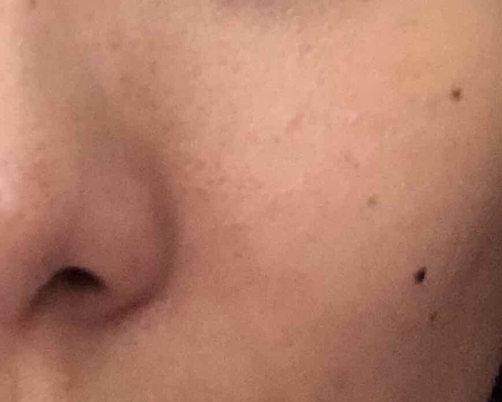 エバレッシュホワイトEXⅡ(医薬品)/matsukiyo/その他を使ったクチコミ(1枚目)