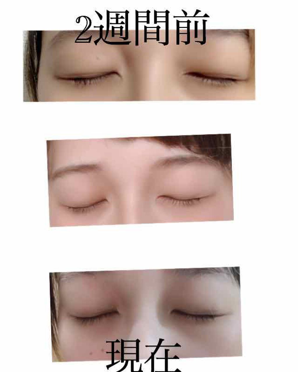 スカルプD ボーテ ピュアフリーアイラッシュセラム/アンファー(スカルプD)/まつげ美容液を使ったクチコミ(3枚目)