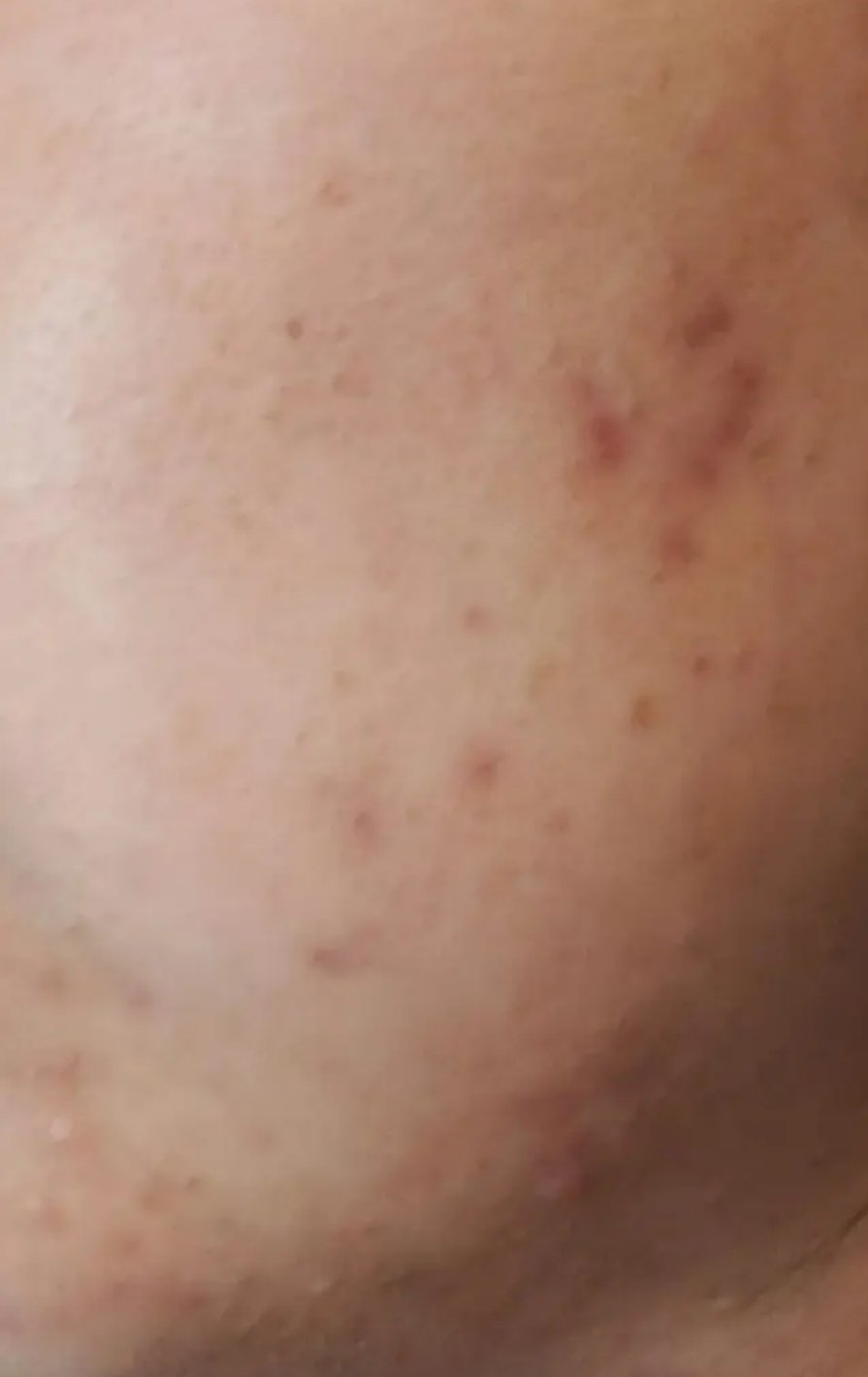 無添加米ぬか洗顔フォーム/ロゼット/洗顔フォームを使ったクチコミ（3枚目）