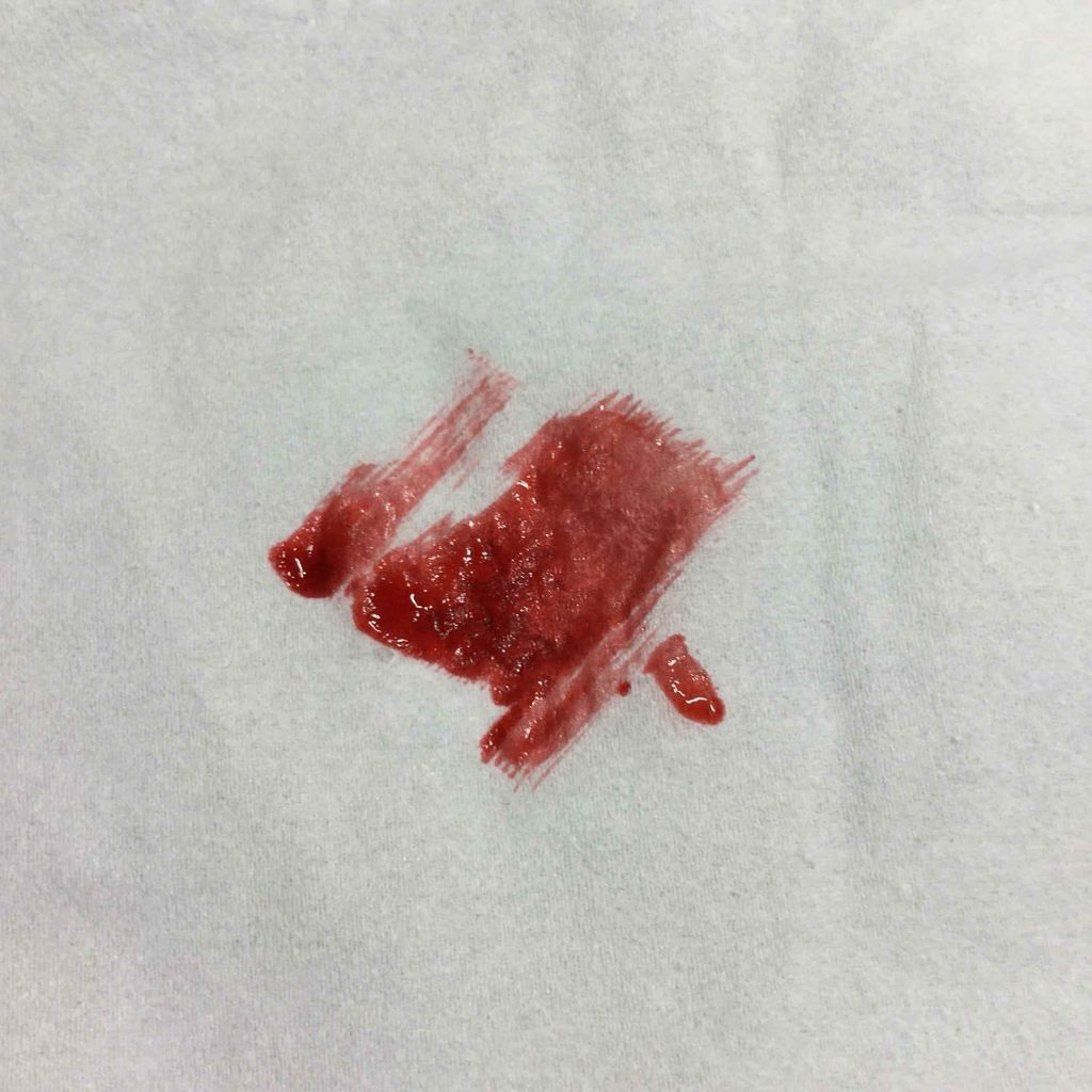 ディアダーリン ウォータージェルティント/ETUDE/リップティントを使ったクチコミ（2枚目）