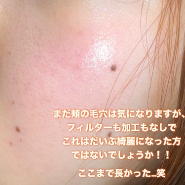 薬用しみ対策 美白化粧水 しっとりタイプ/メラノCC/化粧水を使ったクチコミ（2枚目）